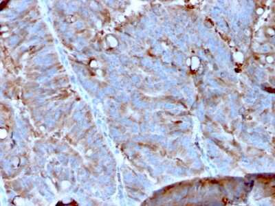 Immunohistochemistry-Paraffin: Mer Antibody (MERTK/3023) [NBP3-13838]