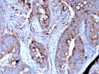 Immunohistochemistry-Paraffin: Mer Antibody (MERTK/3024) [NBP3-13839]