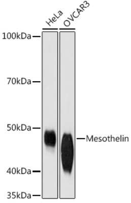 Western Blot: Mesothelin Antibody (5R9H8) [NBP3-16777]