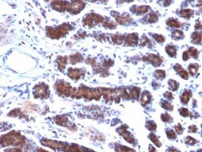 Immunohistochemistry-Paraffin: Mesothelin Antibody (MSLN/2131) - Azide and BSA Free [NBP2-79858]