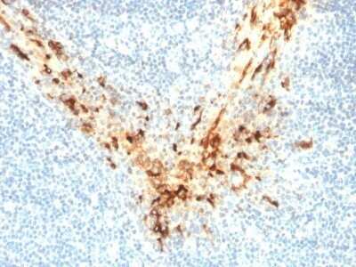 Immunohistochemistry-Paraffin: Mesothelin Antibody (MSLN/2131) - Azide and BSA Free [NBP2-79858]
