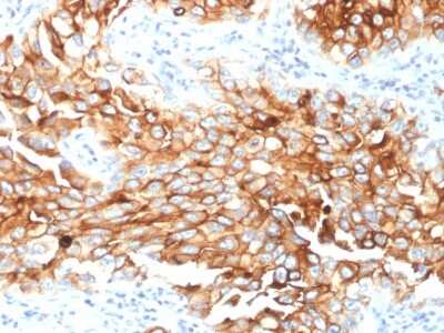 Immunohistochemistry-Paraffin: Mesothelin Antibody (MSLN/2131) [NBP2-79724]