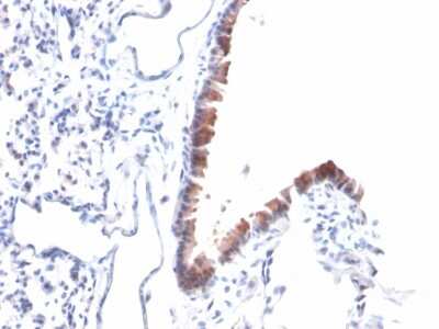 Immunohistochemistry-Paraffin: Mesothelin Antibody (MSLN/2131) [NBP2-79724]