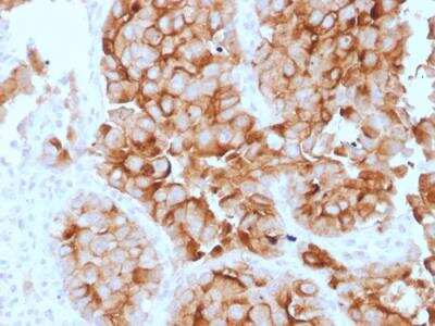 Immunohistochemistry-Paraffin: Mesothelin Antibody (SPM143) [NBP3-09172]