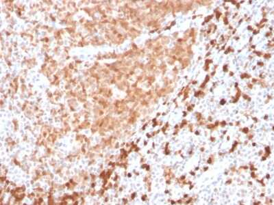 Immunohistochemistry-Paraffin: TCL1A Antibody (TCL1/2747R) - Azide and BSA Free [NBP3-08384]