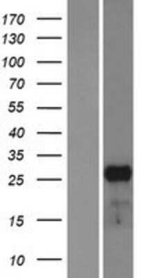 Western Blot: Mesp1 Overexpression Lysate [NBP2-06783]