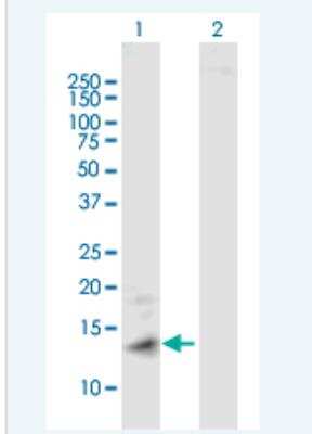 Western Blot: Metallothionein-1A Antibody [H00004489-B01P-50ug]