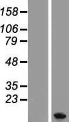 Western Blot: Metallothionein-1F Overexpression Lysate [NBL1-13344]