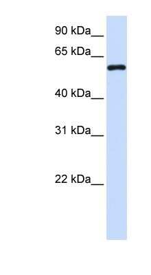 Western Blot: Metaxin 1 Antibody [NBP1-59449]