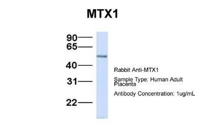 Western Blot: Metaxin 1 Antibody [NBP1-59449]