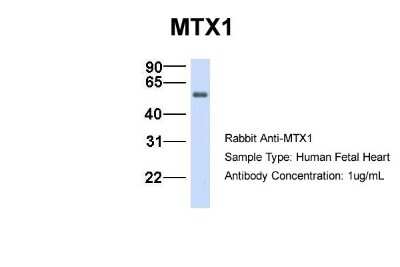 Western Blot: Metaxin 1 Antibody [NBP1-59449]