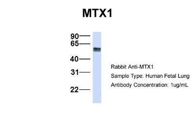 Western Blot: Metaxin 1 Antibody [NBP1-59449]