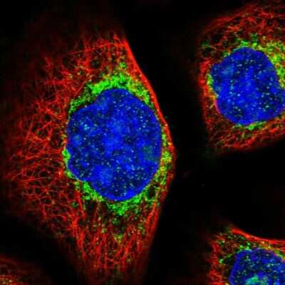Immunocytochemistry/ Immunofluorescence: Metaxin-2 Antibody [NBP1-87436]