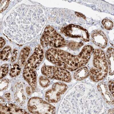 Immunohistochemistry-Paraffin: Metaxin-2 Antibody [NBP1-87434]