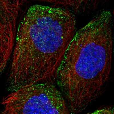 Immunocytochemistry/ Immunofluorescence: Methionine Aminopeptidase 1D/MAP1D Antibody [NBP1-92098]