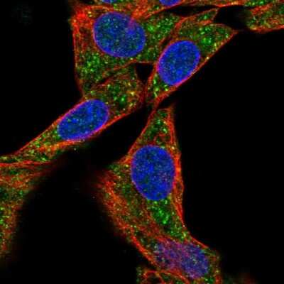 Immunocytochemistry/ Immunofluorescence: Methionine Aminopeptidase 1D/MAP1D Antibody [NBP2-48593]