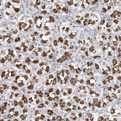 Immunohistochemistry-Paraffin: Methionine Aminopeptidase 1D/MAP1D Antibody [NBP1-92098]