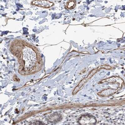 Immunohistochemistry-Paraffin: Methionine Aminopeptidase 1D/MAP1D Antibody [NBP1-92098]