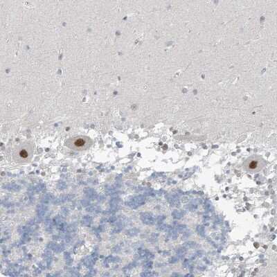 Immunohistochemistry-Paraffin: Methionine Aminopeptidase 1D/MAP1D Antibody [NBP2-48593]