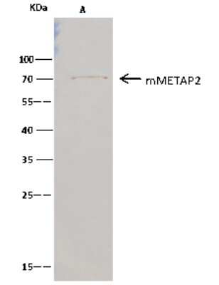 Immunoprecipitation: Methionine Aminopeptidase 2/METAP2 Antibody (010) [NBP2-90623]