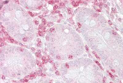 Immunohistochemistry-Paraffin: Methionine Aminopeptidase 2/METAP2 Antibody [NBP2-84161]