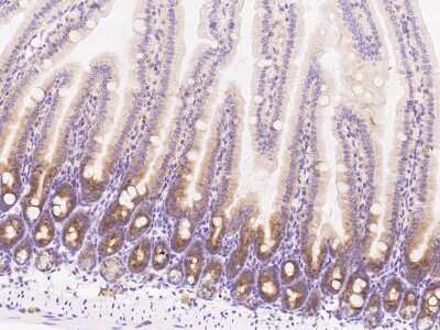 Immunohistochemistry-Paraffin: Methionine Aminopeptidase 2/METAP2 Antibody [NBP2-98941]