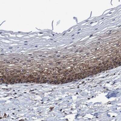 Immunohistochemistry-Paraffin: Methionine Aminopeptidase 2/METAP2 Antibody [NBP3-05513]