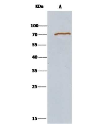 Immunoprecipitation: Methionine Aminopeptidase 2/METAP2 Antibody [NBP2-98289]