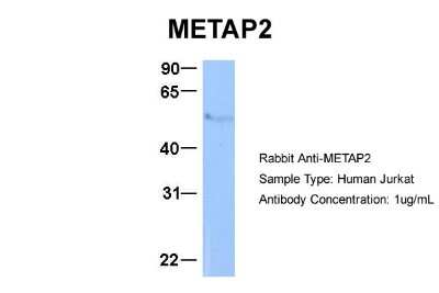 Western Blot: Methionine Aminopeptidase 2/METAP2 Antibody [NBP2-84161]