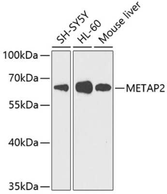 Western Blot: Methionine Aminopeptidase 2/METAP2 AntibodyBSA Free [NBP3-03365]