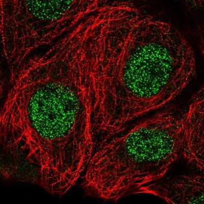 Immunocytochemistry/ Immunofluorescence: Methionine Sulfoxide Reductase A Antibody [NBP2-55671]