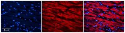 Immunohistochemistry: Methionine Sulfoxide Reductase A Antibody [NBP1-57727]