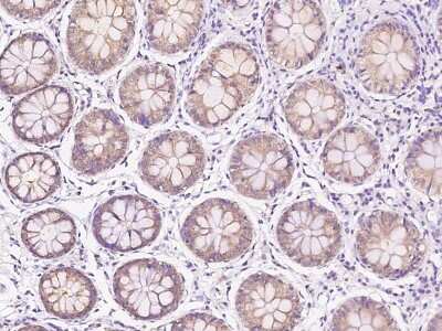 Immunohistochemistry-Paraffin: Methionine Sulfoxide Reductase A Antibody [NBP2-97475]