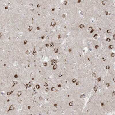 Immunohistochemistry: Methionyl tRNA synthetase 2 Antibody [NBP2-34013]