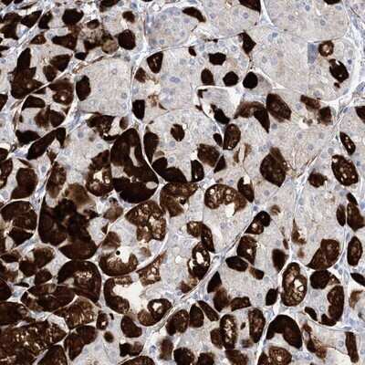 Immunohistochemistry-Paraffin: Methionyl tRNA synthetase 2 Antibody [NBP1-92106]