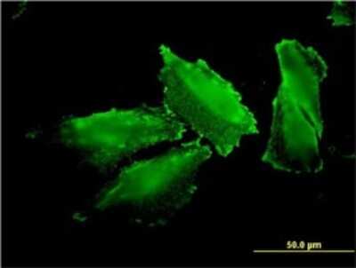 Immunocytochemistry/ Immunofluorescence: Methionyl tRNA synthetase Antibody (5G5) [H00004141-M01]