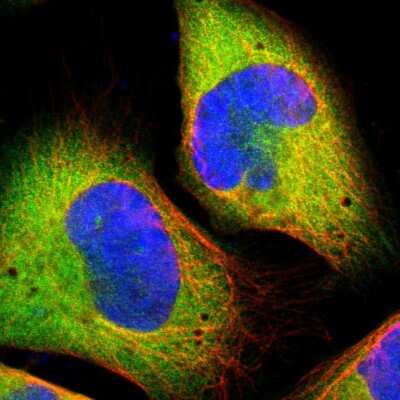 Immunocytochemistry/ Immunofluorescence: Methionyl tRNA synthetase Antibody [NBP1-87730]