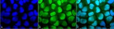 Immunocytochemistry/ Immunofluorescence: Methyl-Lysine Antibody [NB600-824]