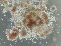 Tips to Identify CFU-GEMM Colonies in the Human Colony Forming Unit Assay.
