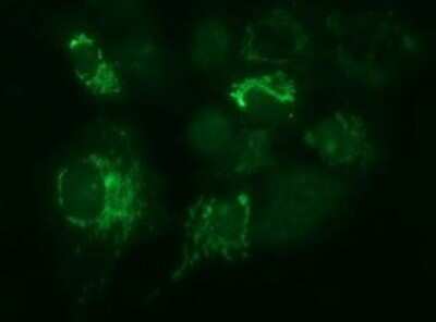 Immunocytochemistry/ Immunofluorescence: Methylmalonyl Coenzyme A mutase Antibody (OTI2C8) - Azide and BSA Free [NBP2-72652]