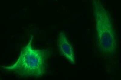 Immunocytochemistry/ Immunofluorescence: Methylmalonyl Coenzyme A mutase Antibody (OTI2C8) - Azide and BSA Free [NBP2-72652]