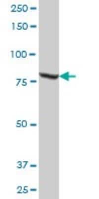 Western Blot: Methylmalonyl Coenzyme A mutase Antibody [H00004594-B01P]