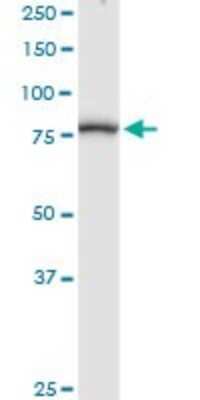 Western Blot: Methylmalonyl Coenzyme A mutase Antibody [H00004594-D01P]