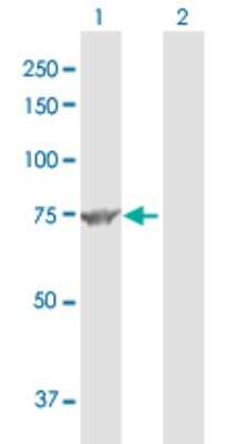 Western Blot: Methylmalonyl Coenzyme A mutase Antibody [H00004594-D01P]