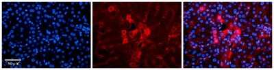Immunohistochemistry: Methyltransferase like 5 Antibody [NBP1-56640]