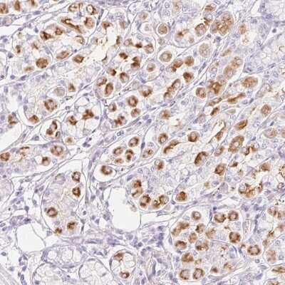 Immunohistochemistry: MiRP1 Antibody [NBP2-38146]