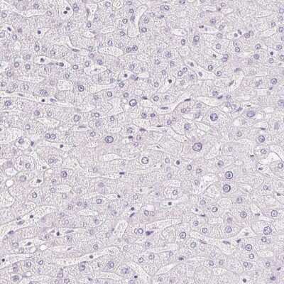 Immunohistochemistry-Paraffin: MiRP1 Antibody [NBP2-38146]