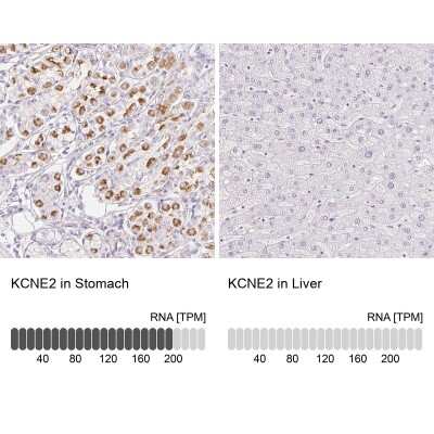 Immunohistochemistry-Paraffin: MiRP1 Antibody [NBP2-38146]