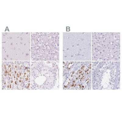 Immunohistochemistry-Paraffin: MiRP1 Antibody [NBP2-38146]