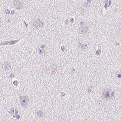 Immunohistochemistry-Paraffin: MiRP1 Antibody [NBP2-38146]